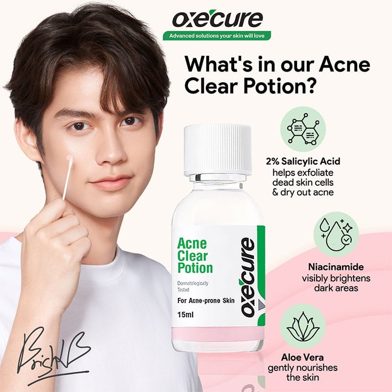 Acne-Clear-Potion-1.jpg OXECURE Acne Clear Potion