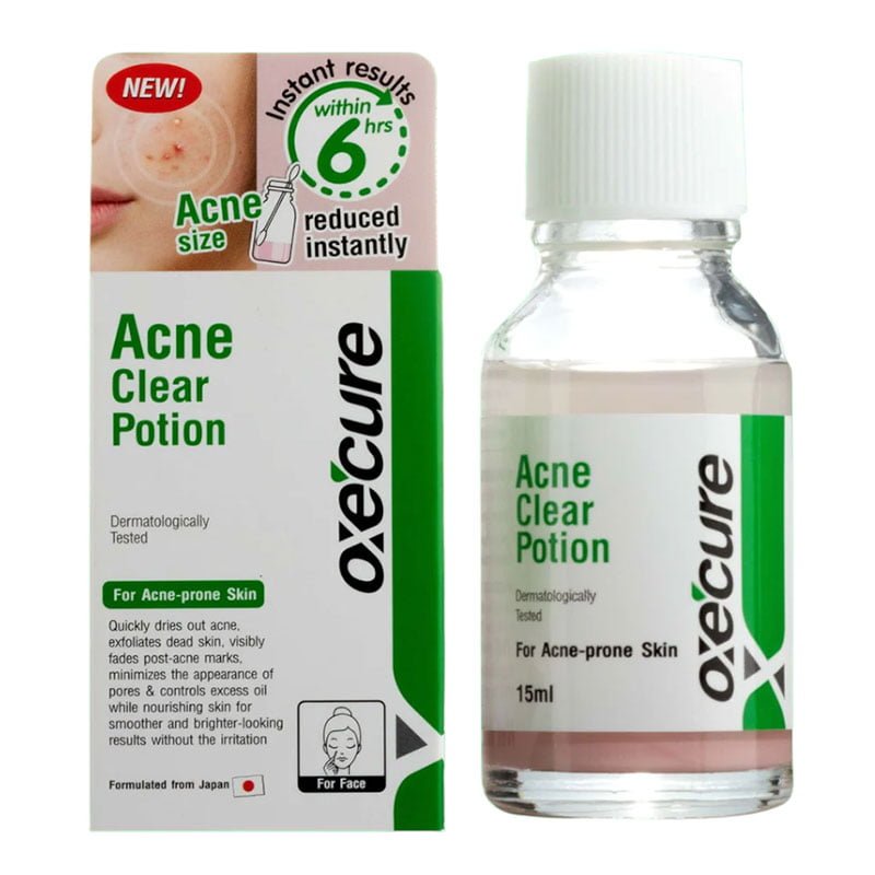 Acne-Clear-Potion.jpg OXECURE Acne Clear Potion