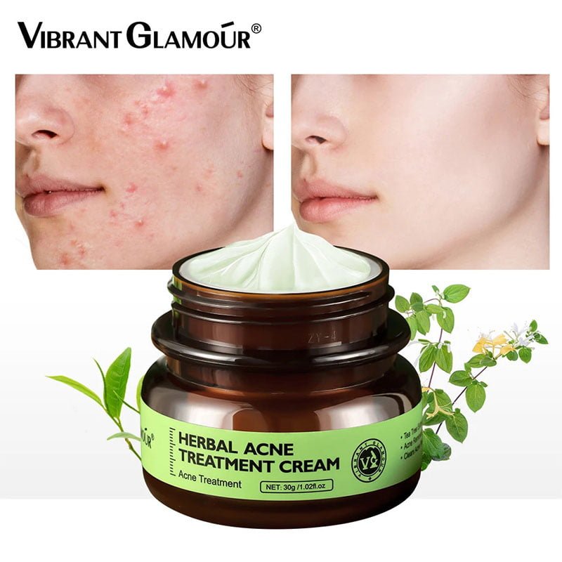 VIBRANT GLAMOUR Herbal Acne Treatment Cream 30g