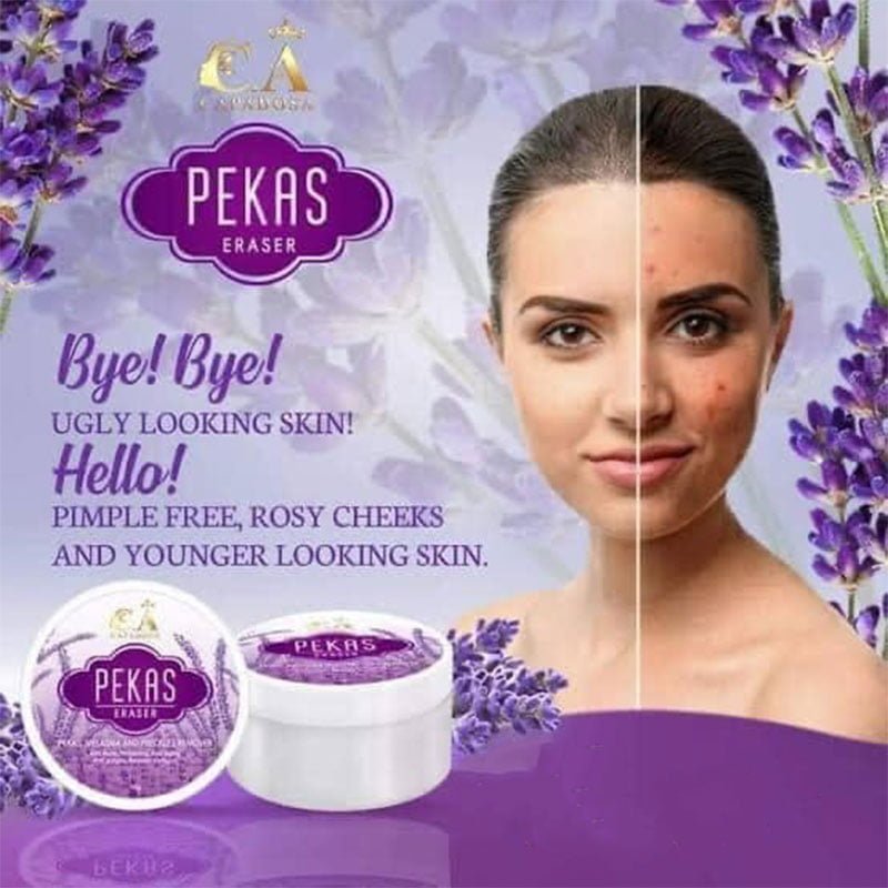 Pekas-Cream-1-1.jpg CAPADOSA Pekas Eraser Cream 10g