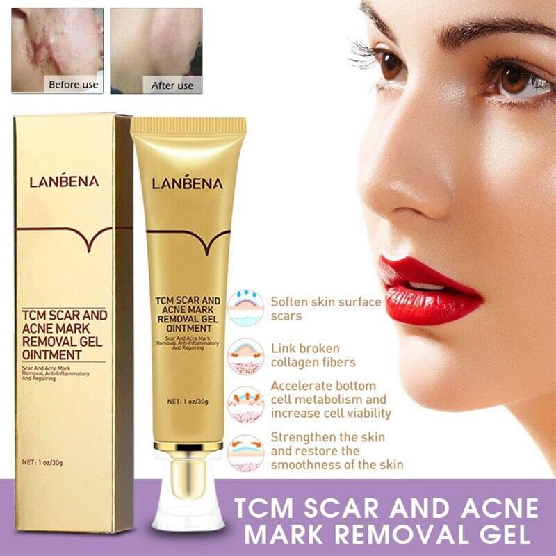 Scar-Removing-Gel-1-1.jpg Lanbena TCM Scar and Acne Mark Removal Gel Ointment