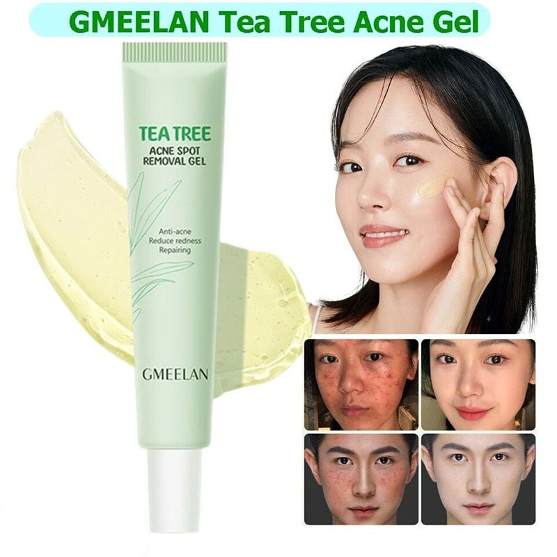 Tea-Tree-cne-Spot-1.jpg Gmeelan Tea Tree Acne Spot Romoval Gel Anti-Acne Reduce Redness Repairing 20g