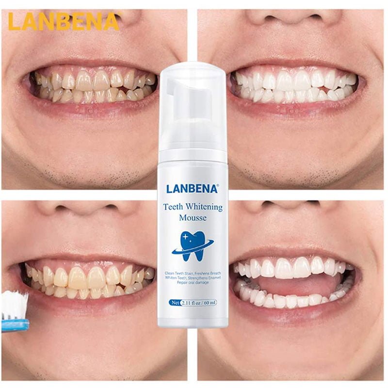 Teeth-Whitening-Mousse-1.jpg Lanbena Teeth Whitening Mousse Oral Hygiene Cleaning Tool Remove Stain Teeth Whitening Foam