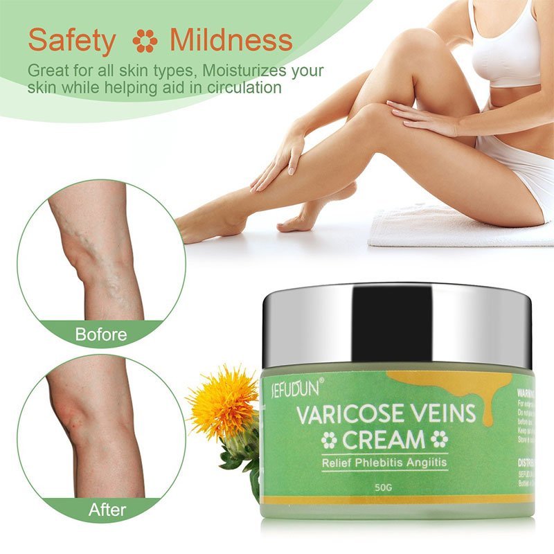 SEFUDUN Varicose Veins Cream Relief Phlebitis Angiitis 50g