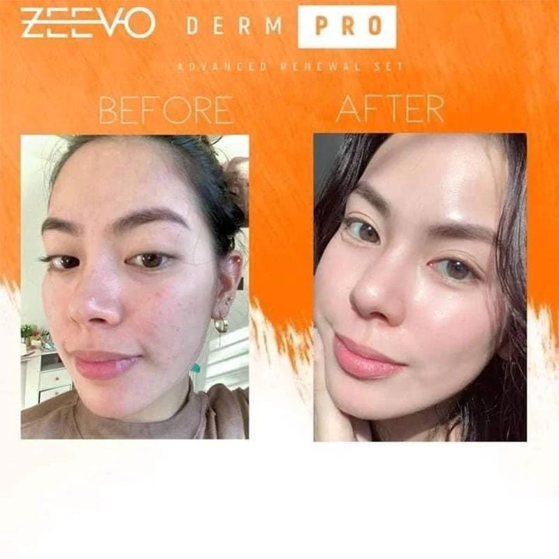Zeevo-Derm-Pro-2.jpg Zeevo Derm Pro Advance Renewal Set
